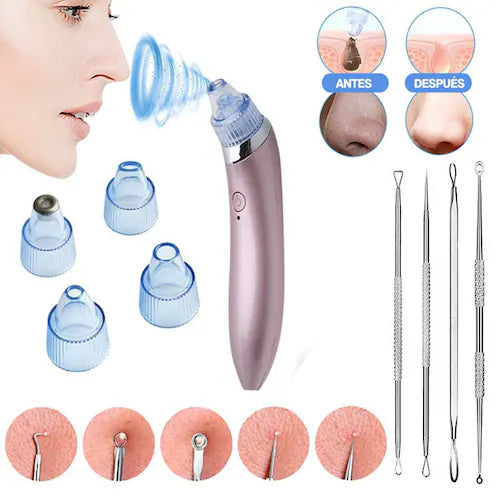Kit de Limpieza Facil: Extractor de Puntos Negros, Espinillas y Grasa Facial + Juego de herramientas de acero inoxidable