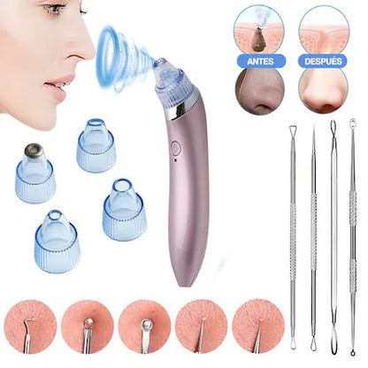 Kit de Limpieza Facil: Extractor de Puntos Negros, Espinillas y Grasa Facial + Juego de herramientas de acero inoxidable
